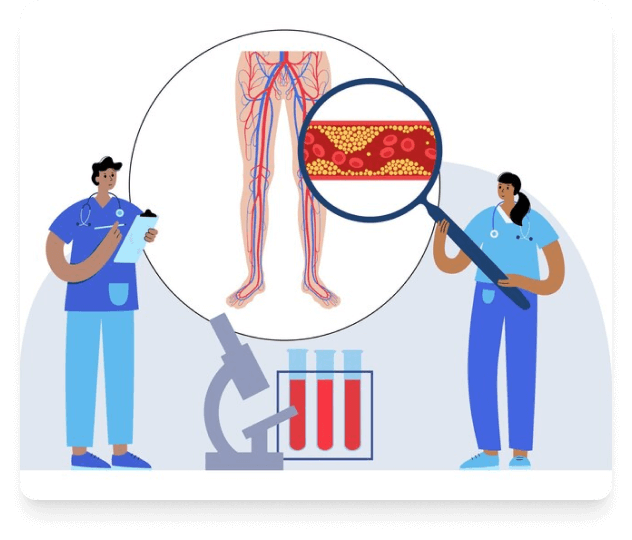 varicose Treatment In Hyderabad