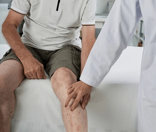 varicose Treatment In Hyderabad