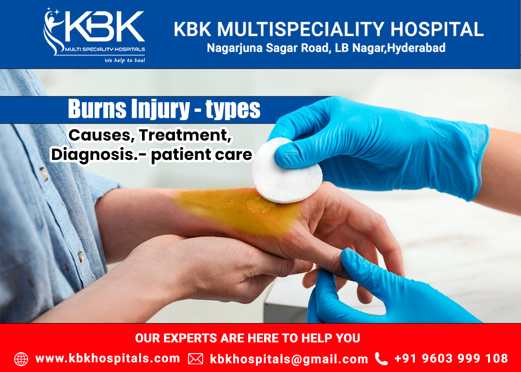 Acid Wounds Archives kbkhopitals