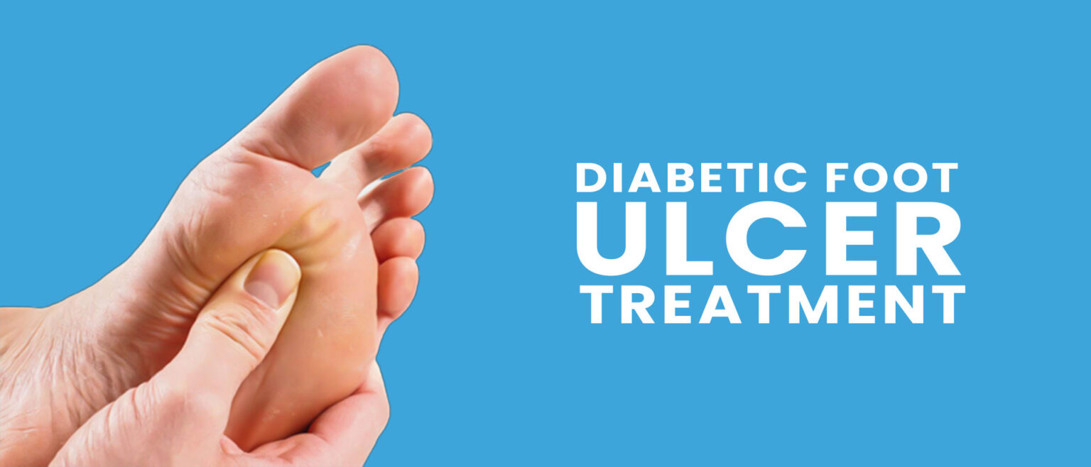 Diabetic Foot Ulcers Symptoms, Treatment, and Prevention