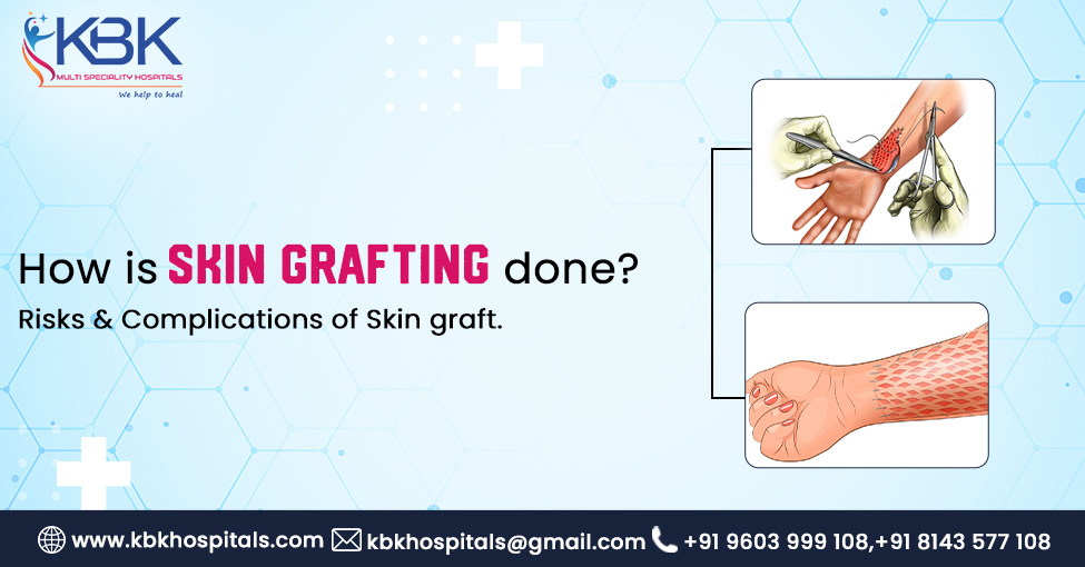 How-is-skin-grafting-is-done-its-risks-complications-of-Skin-graft.