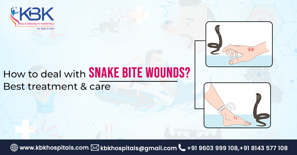 How to deal with Snake bite wounds, Best treatment & care.