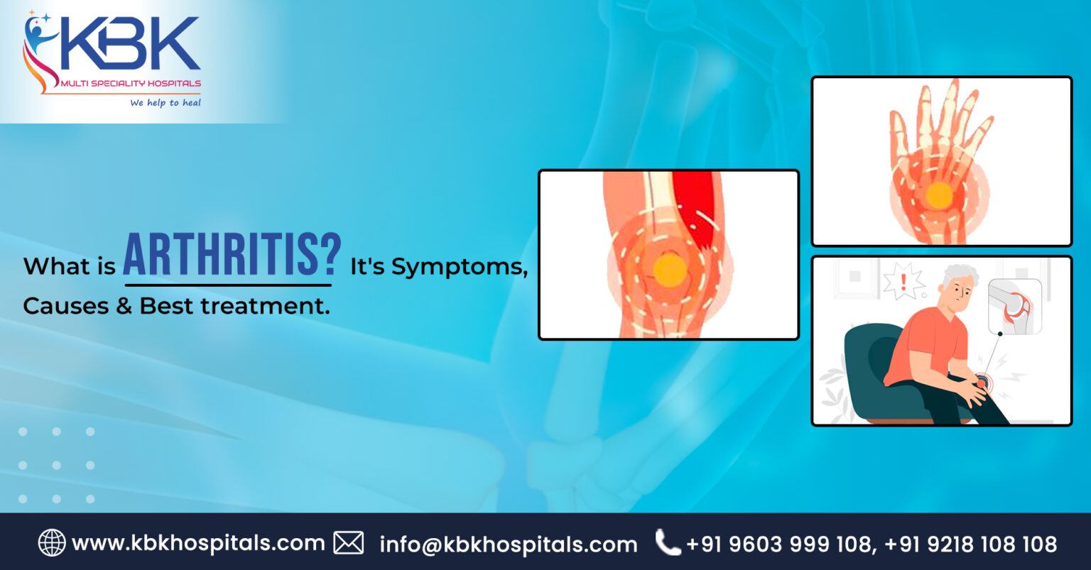Best Arthritis treatment available? Arthritis Symptoms & Causes