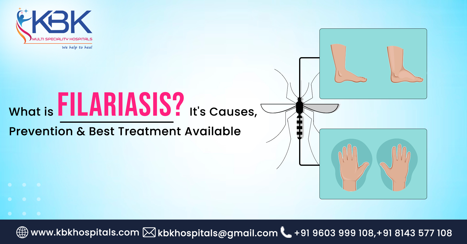 What is Filariasis? It's Causes, Prevention & Best treatment available.