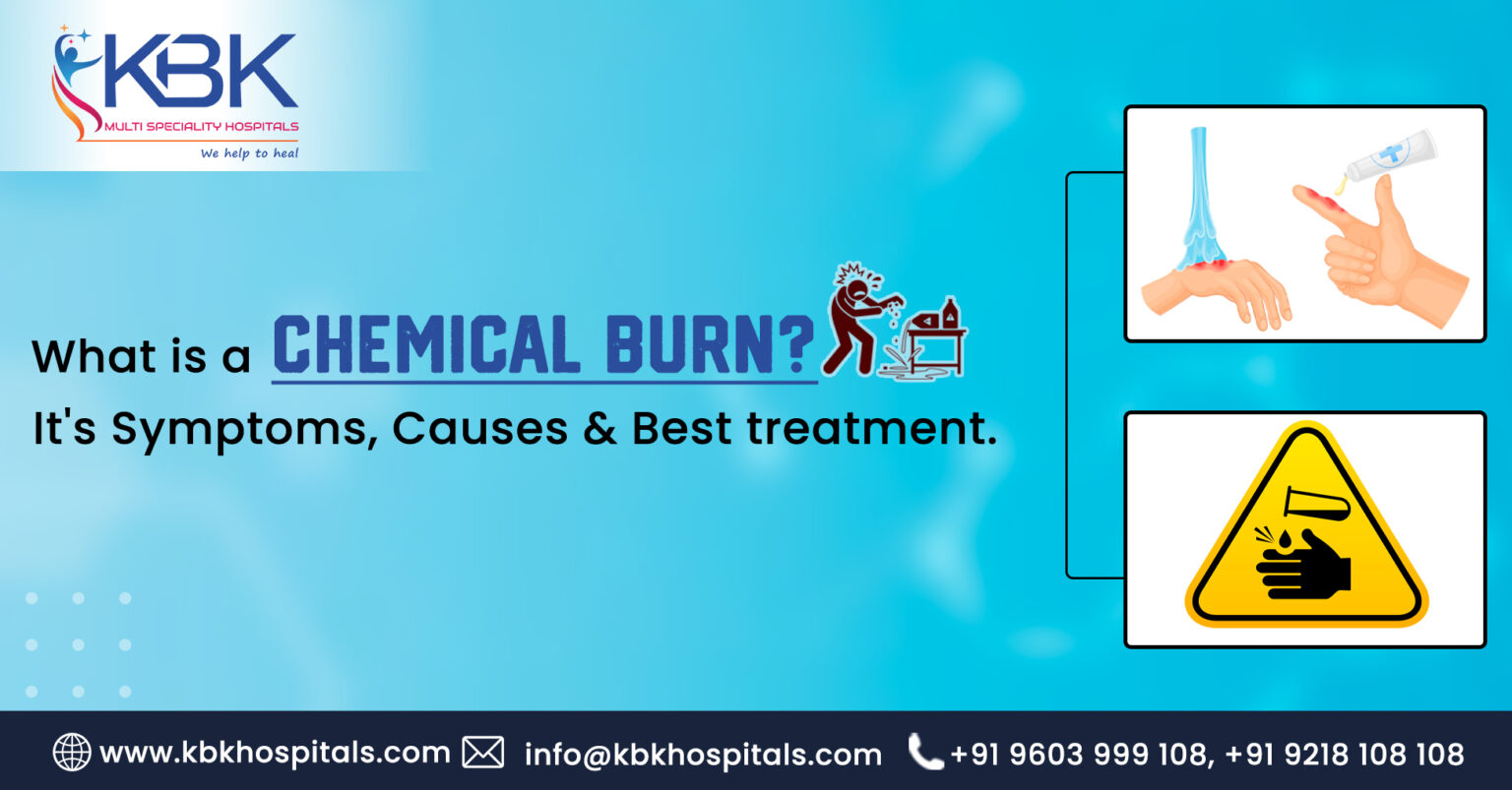 What is a Chemical Burn? Symptoms, Causes & Best Treatment.