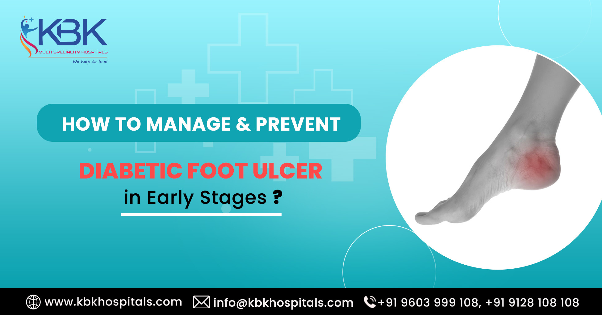 How to manage & prevent Diabetic Foot Ulcer in Early Stages - KBK HOSPITALS BLOG IMAGE 2023.