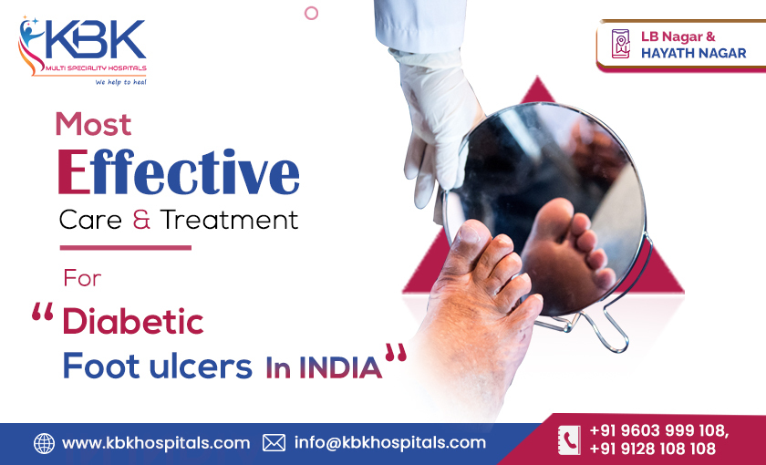 Most Effective Care & treatment for Diabetic Foot ulcers in India - KBK Hospitals 2023 BLOG IMAGE.