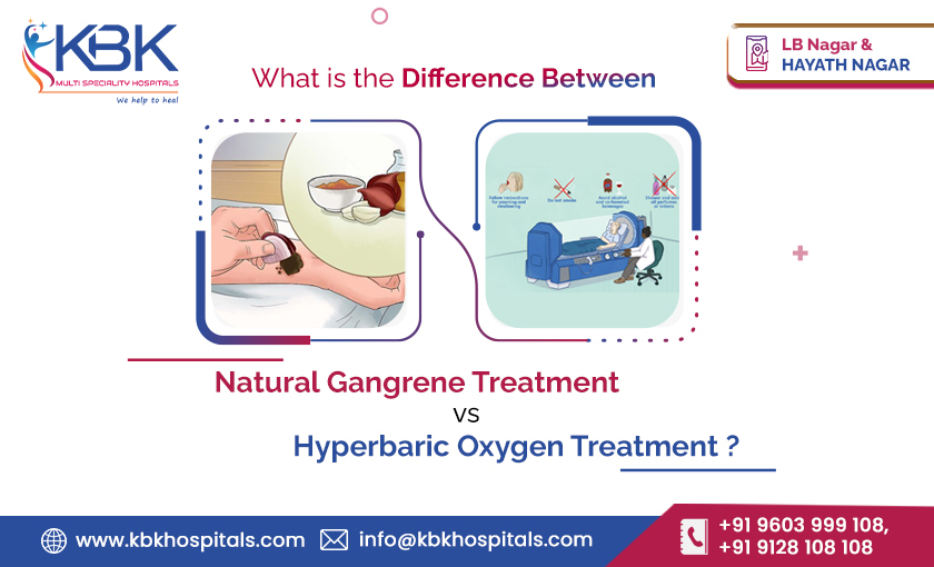 Natural Gangrene treatment vs. Hyperbaric Oxygen treatment - KBK Hospitals 2023 BLOG IMAGE.