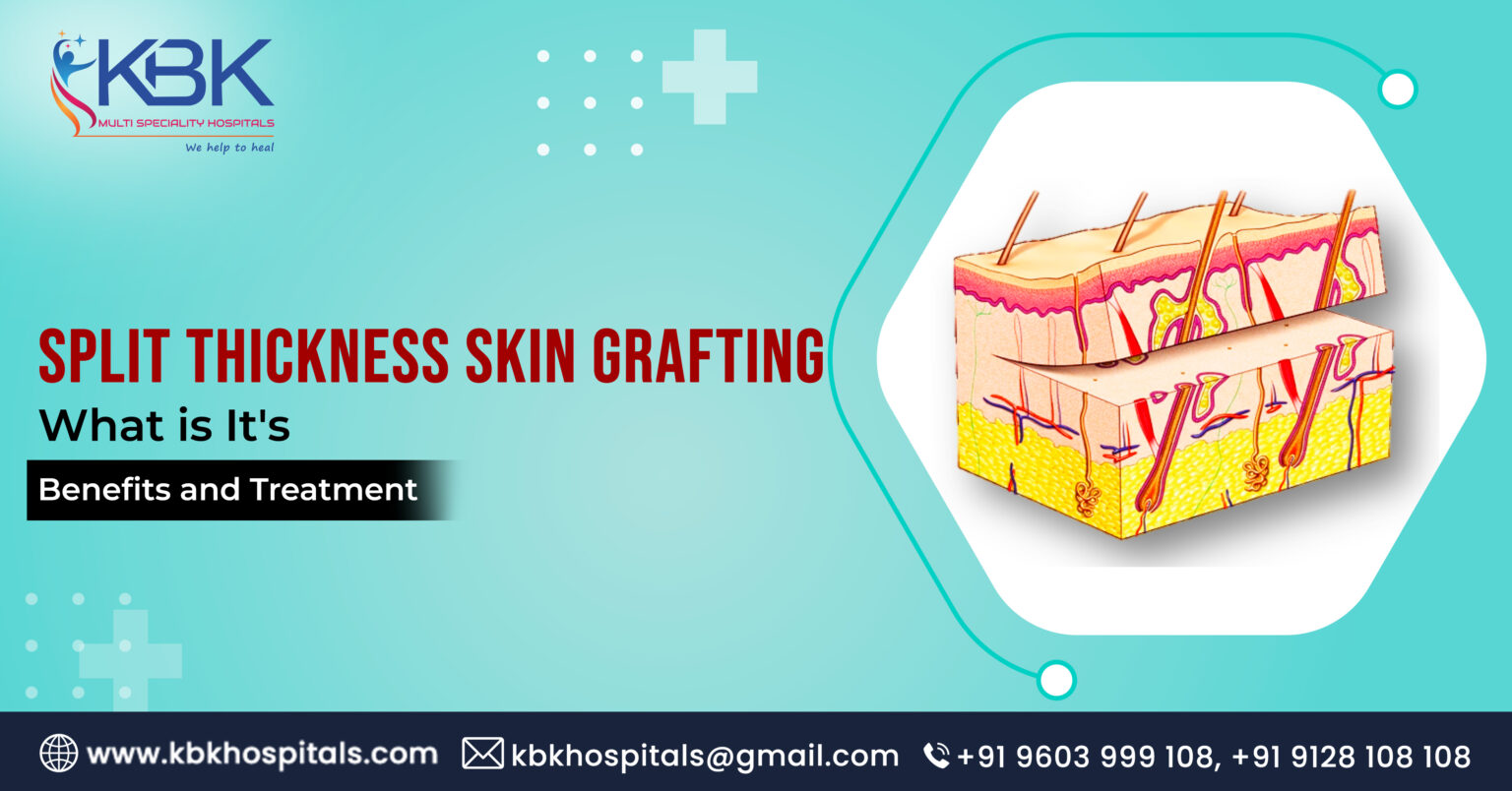 Split thickness Skin grafting What is It's Benefits and Treatment