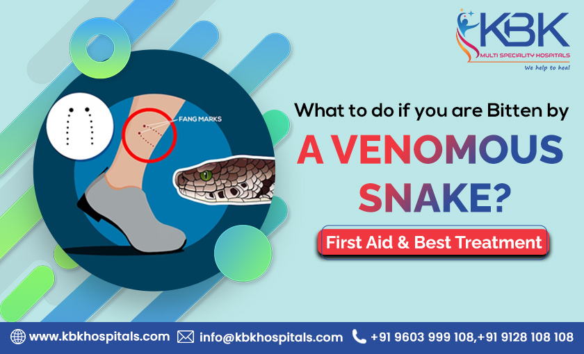 What to do if you are Bitten by a Venomous Snake First aid & Best treatment - KBK HOSPITALS BLOG IMAGE 2023.