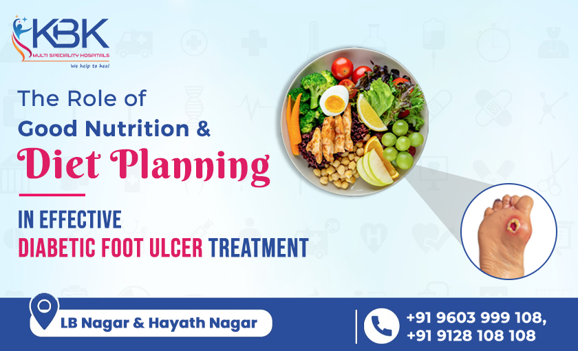 The Role of Good Nutrition and Diet-Planning in Effective Diabetic Foot Ulcer Treatment - KBK HOSPITALS 2023 (BLOG IMAGE)