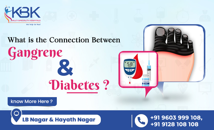 What is the Connection between Gangrene & Diabetes Know more here - KBK HOSPITALS 2023