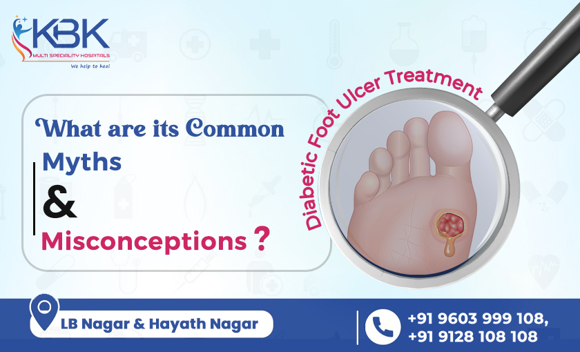 Diabetic Foot Ulcer Treatment What are it's Common Myths and Misconceptions (Blog image) - KBK HOSPITALS 2023.