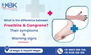 What is the Difference Between Frostbite and Gangrene Their Symptoms and Warning Signs