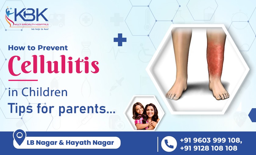 How to Prevent Cellulitis in Children: Tips for Parents