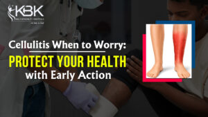 cellulitis when to worry