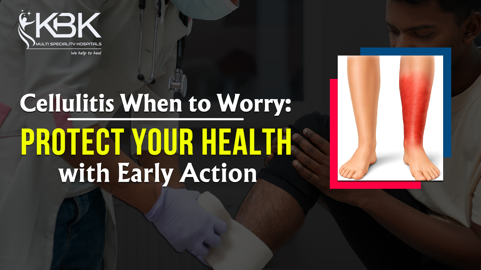 cellulitis when to worry