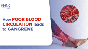 Poor Blood Circulation