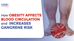 Obesity Risk