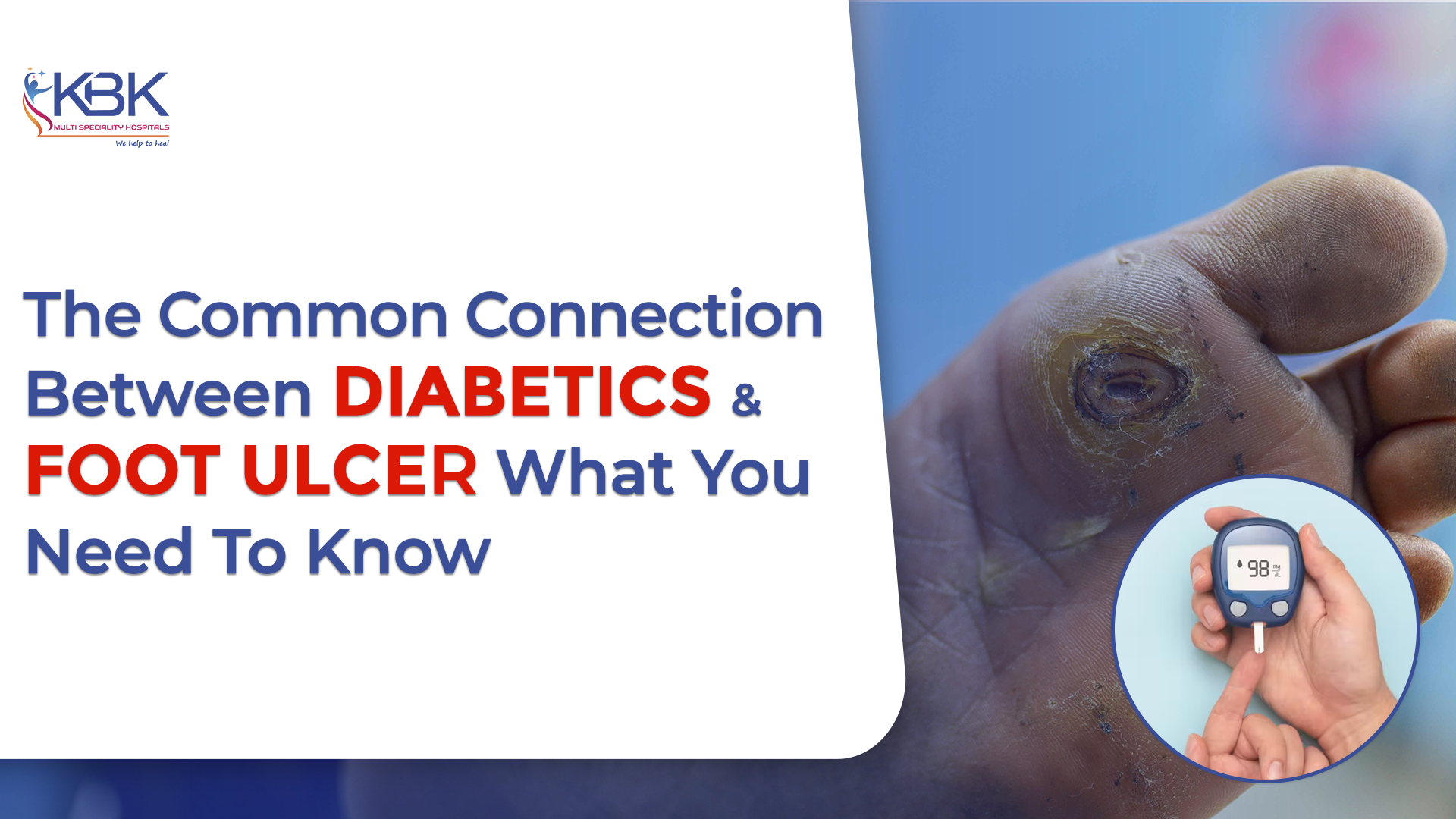 diabetic foot ulcers