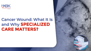 cancer wound