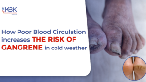How Poor Blood Circulation Increases the Risk of Gangrene in Cold Weather