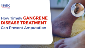 How Timely Gangrene Disease Treatment Can Prevent Amputation