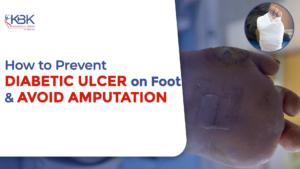 diabetic ulcer on foot