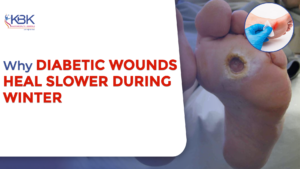 diabetic wounds