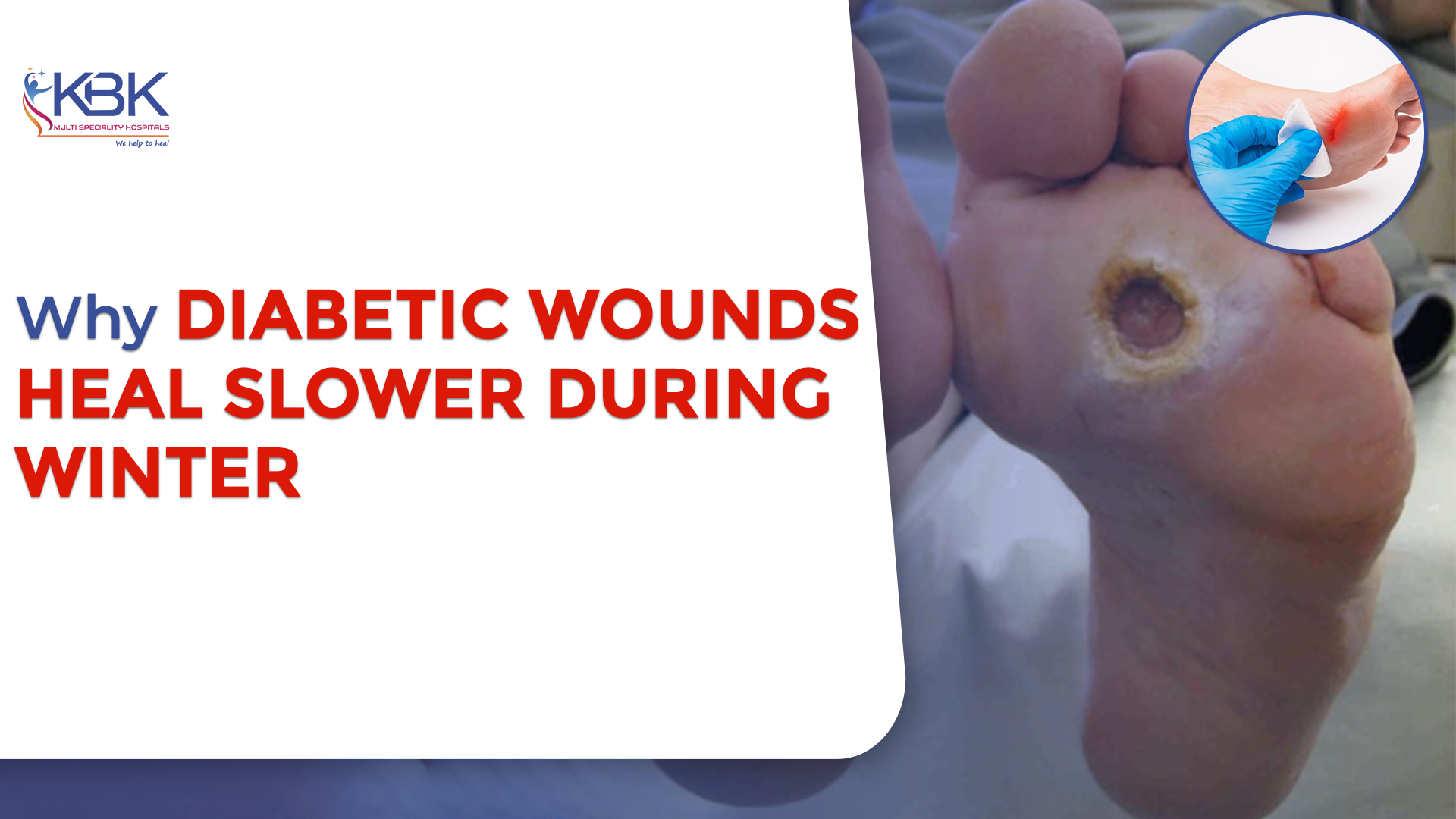 Why Diabetic Wounds Heal Slower During Winter