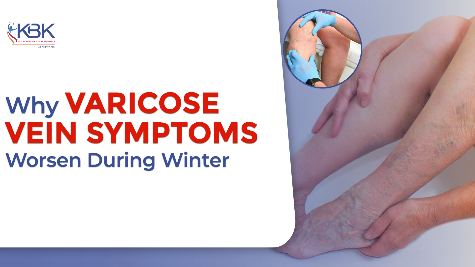 Why Varicose Vein Symptoms Worsen During Winter