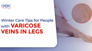 Winter Care Tips for People with Varicose Veins in Legs