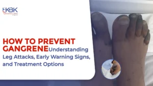 How To Prevent Gangrene