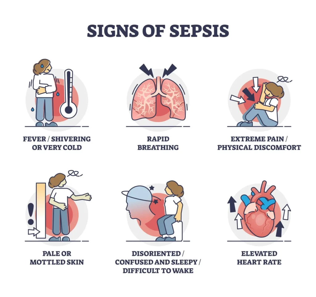 Early Signs of Sepsis