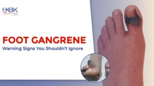 Foot Gangrene