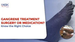 Gangrene Treatment