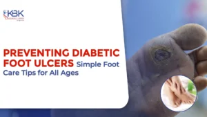 Preventing Diabetic Foot Ulcers