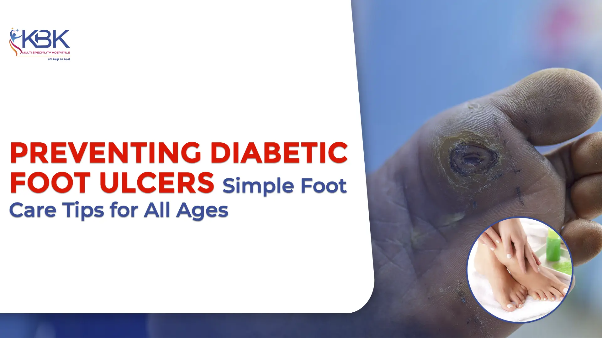 Preventing Diabetic Foot Ulcers