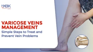 Varicose Veins Management