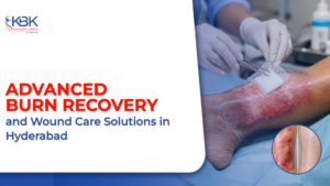 Burns Care Treatment in Hyderabad