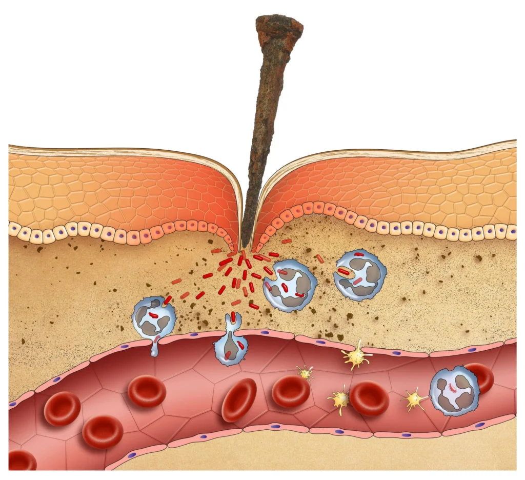 Common warning signs of severe infection infographic