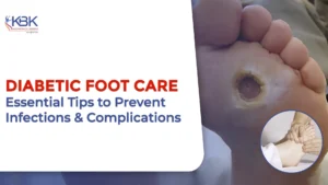 Diabetic Foot Care