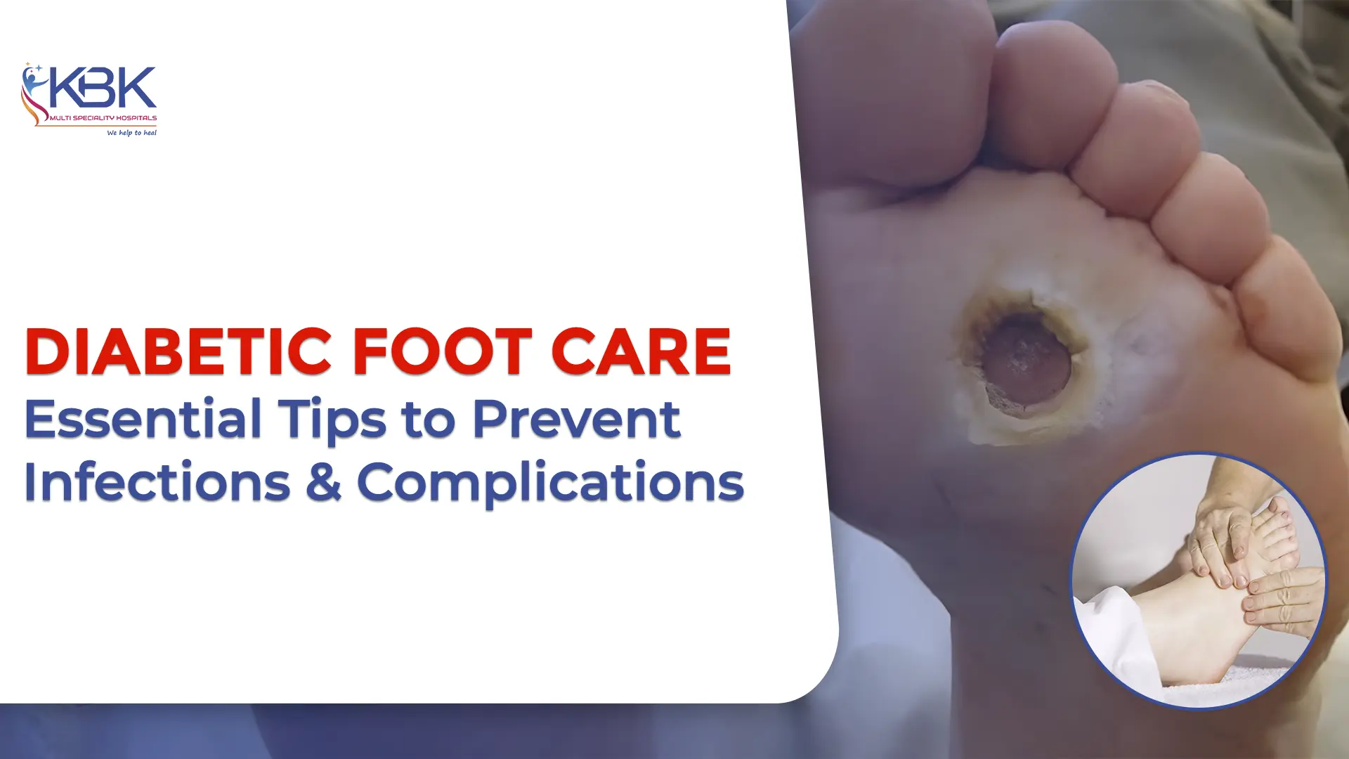 Diabetic Foot Care: Essential Tips to Prevent Infections and Complications