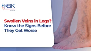 visible veins in legs