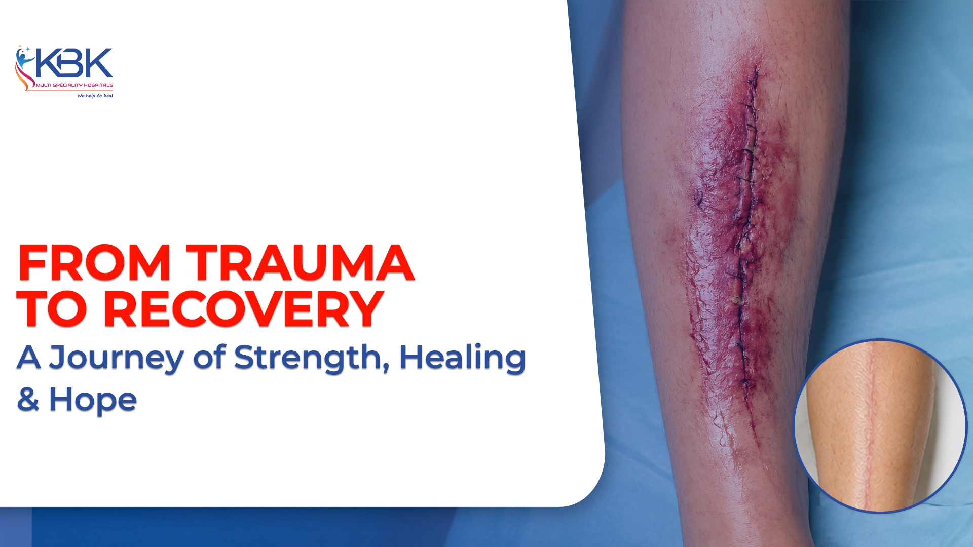 From Trauma to Recovery: A Journey of Strength, Healing &amp; Hope