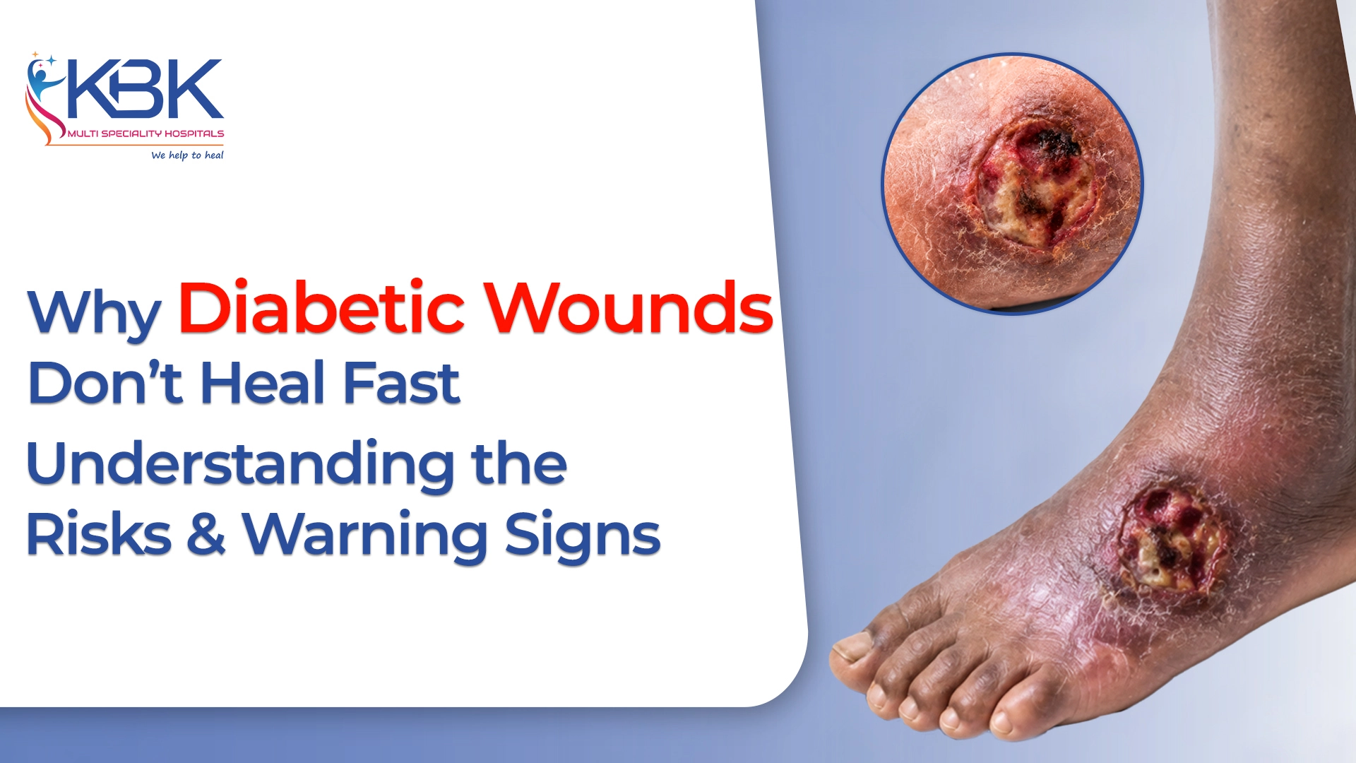 Why Diabetic Wounds Don’t Heal Fast