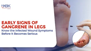 Early signs of gangrene in legs with infected wound symptoms