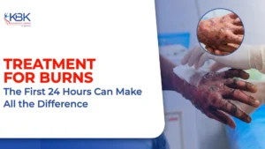 Treatment for burns
